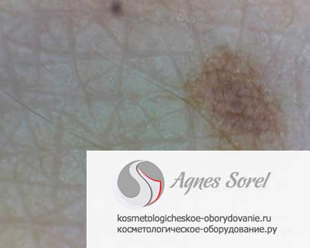 микроскоп для структуры кожи